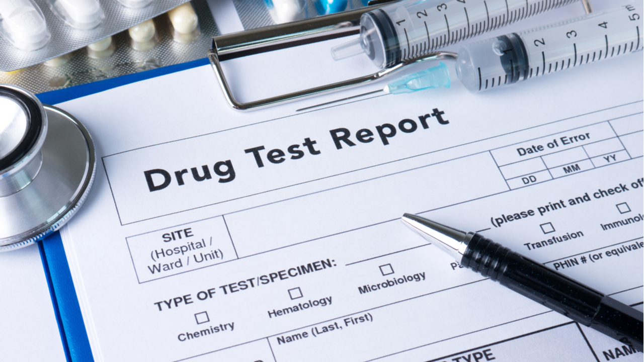 Does CBD show up on a drug test? Here’s what you need to know
