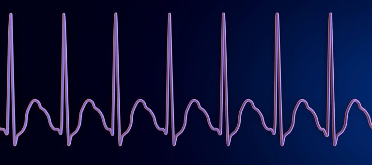 Heart Rate Variability In Athletes: Optimizing Your Training